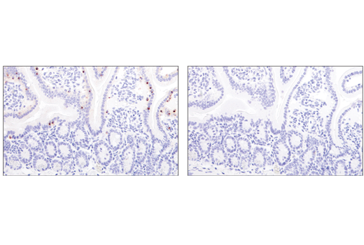 Immunohistochemistry Image 2: Granzyme B (E5V2L) Rabbit Monoclonal Antibody