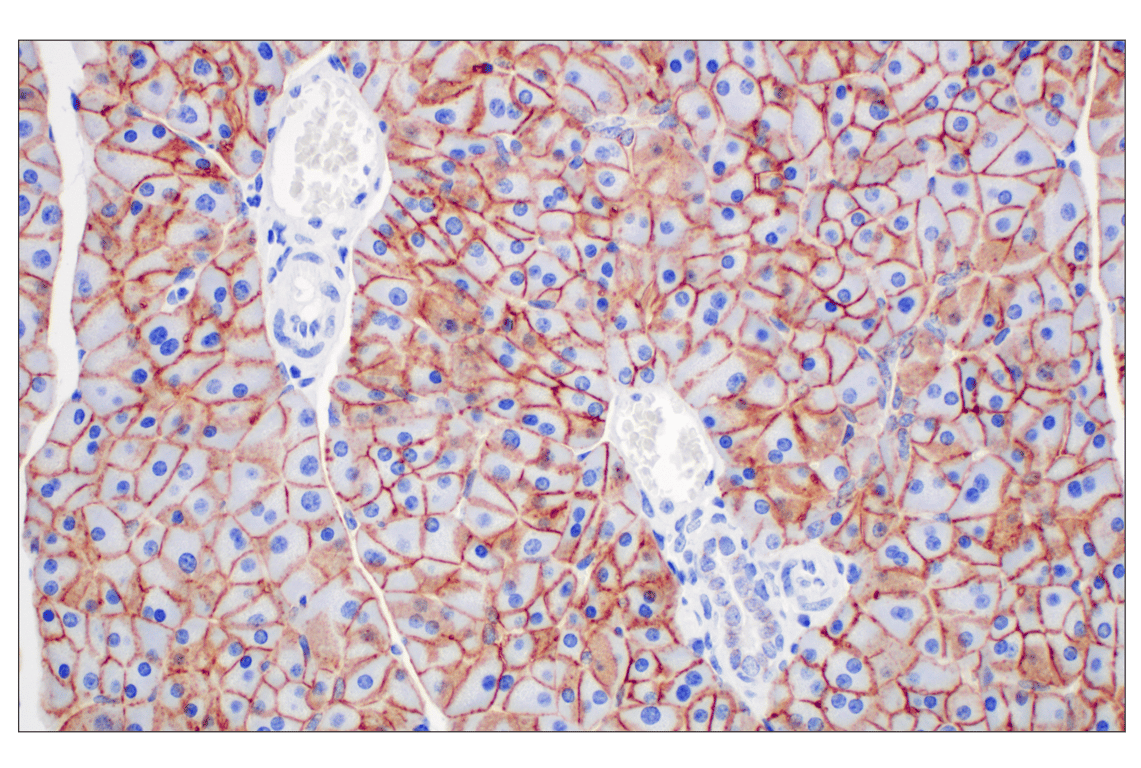 Immunohistochemistry Image 8: EpCAM (D9S3P) Rabbit Monoclonal Antibody (BSA and Azide Free)
