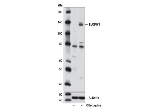 Western Blotting Image 3: TECPR1 (D6C10) Rabbit Monoclonal Antibody