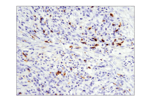Immunohistochemistry Image 1: GITR (D5V7P) Rabbit Monoclonal Antibody (BSA and Azide Free)