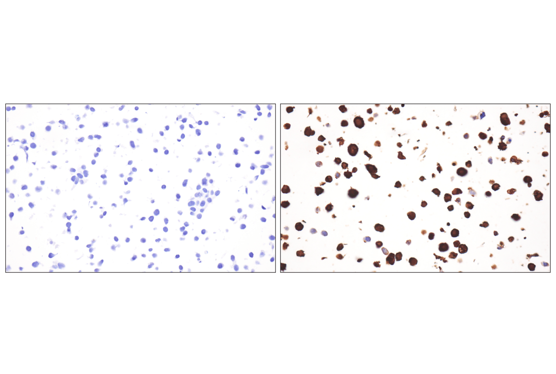Immunohistochemistry Image 4: Respiratory Syncytial Virus (RSV) Nucleoprotein (N) (F5S9J) Rabbit Monoclonal Antibody