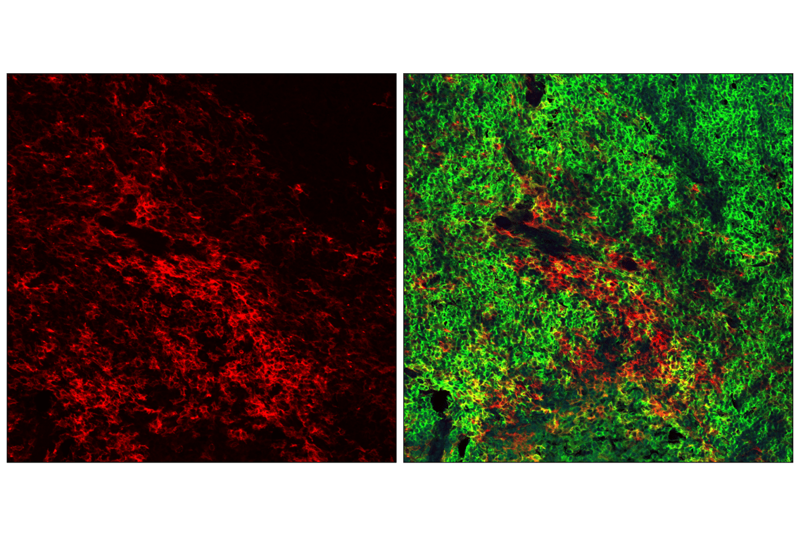 Immunofluorescence Image 2: CD11c (D1V9Y) Rabbit Monoclonal Antibody (Alexa Fluor<sup>®</sup> 555 Conjugate)