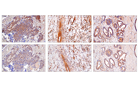 Immunohistochemistry Image 5: RIP (E8S7U) Rabbit Monoclonal Antibody (BSA and Azide Free)