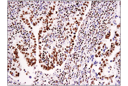 Immunohistochemistry Image 1: Tri-Methyl-Histone H3 (Lys36) (D5A7) Rabbit Monoclonal Antibody
