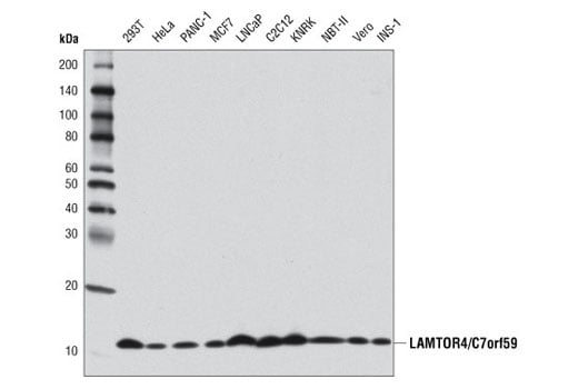 Western Blotting Image 1: LAMTOR4/C7orf59 (D6A4V) Rabbit mAb