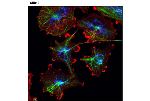 Immunofluorescence Image 3: ProLong<sup>®</sup> Gold Antifade Reagent