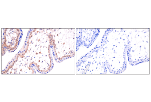 Immunohistochemistry Image 12: VHL (E3X9K) Rabbit Monoclonal Antibody (BSA and Azide Free)
