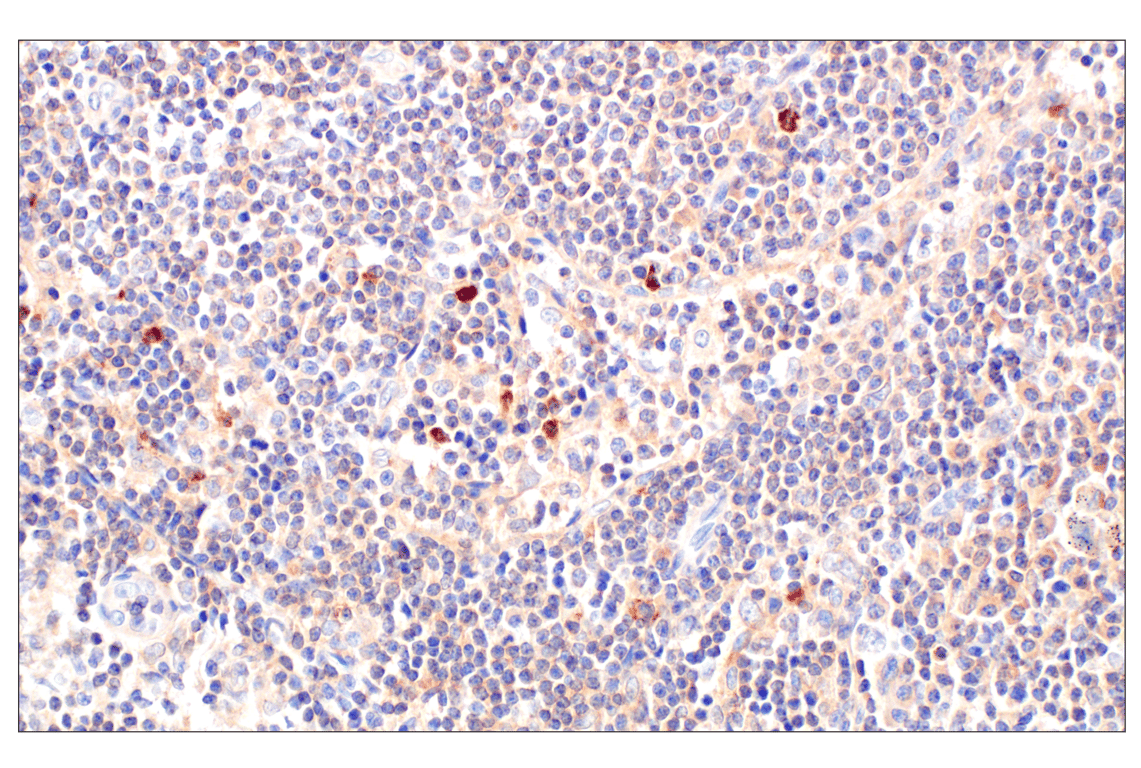 Immunohistochemistry Image 4: RhoA (67B9) Rabbit Monoclonal Antibody