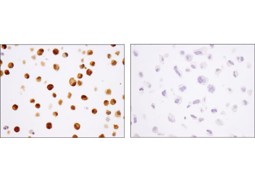 Immunohistochemistry Image 4: Stat5 (D3N2B) Rabbit Monoclonal Antibody (BSA and Azide Free)