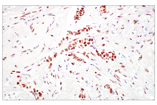 Immunohistochemistry Image 6: Rad50 (E4J5R) Rabbit Monoclonal Antibody
