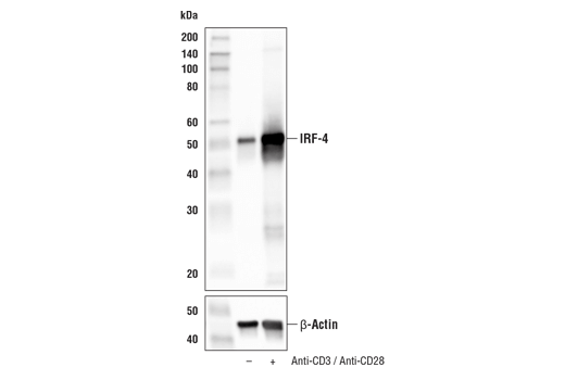 Western Blotting Image 4: IRF-4 (E8H3S) Rabbit Monoclonal Antibody (BSA and Azide Free)
