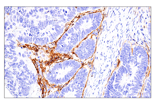 Immunohistochemistry Image 1: NCAM1 (CD56) (E7X9M) Rabbit Monoclonal Antibody (BSA and Azide Free)