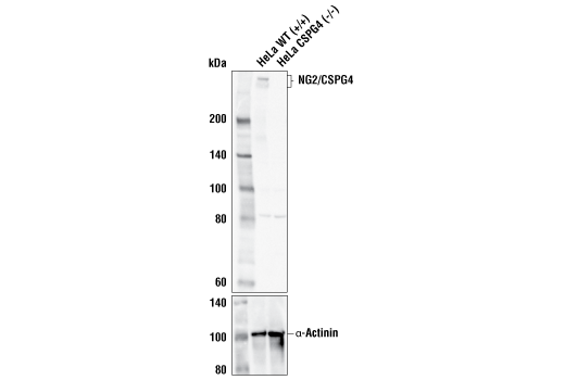 Western Blotting Image 3: NG2/CSPG4 (E3B3G) Rabbit Monoclonal Antibody