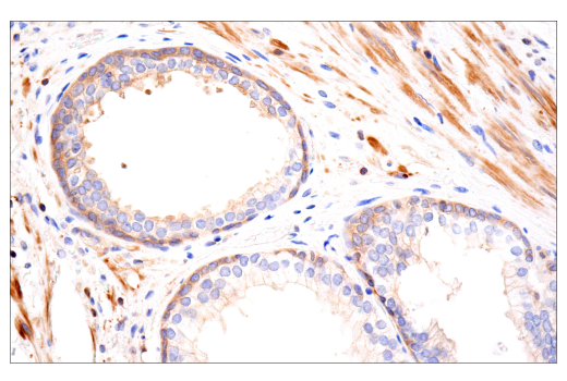 Immunohistochemistry Image 7: MYPT1 (D6C1) Rabbit Monoclonal Antibody (BSA and Azide Free)