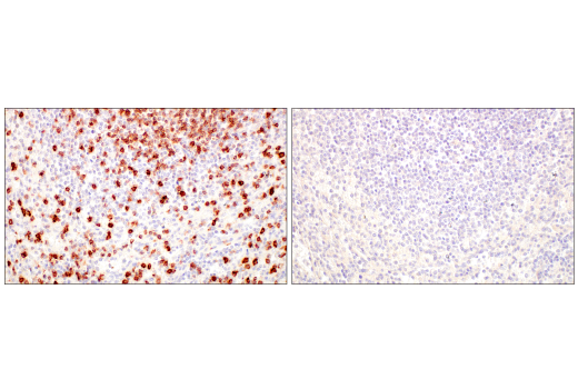 Immunohistochemistry Image 9: CD7 (E4G1Q) Rabbit Monoclonal Antibody