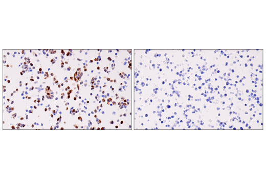 Immunohistochemistry Image 7: Cyclin D1 (E3P5S) Rabbit Monoclonal Antibody (BSA and Azide Free)
