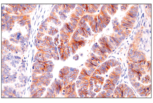 Immunohistochemistry Image 1: Semaphorin-4D/CD100 (E5C3B) Rabbit Monoclonal Antibody