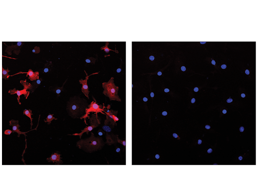 Immunofluorescence Image 1: Arginase-1 (D4E3M<sup>™</sup>) XP<sup>®</sup> Rabbit mAb (Alexa Fluor<sup>®</sup> 647 Conjugate)