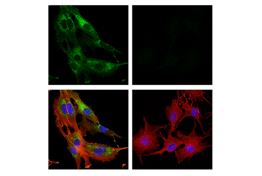 Immunofluorescence Image 1: FAP (E1V9V) Rabbit Monoclonal Antibody (BSA and Azide Free)