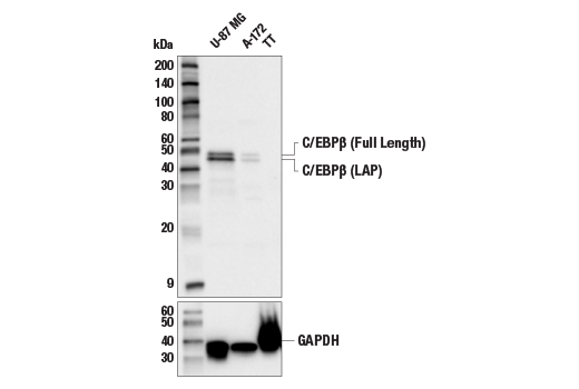 Western Blotting Image 1: C/EBPβ (E2K1U) Rabbit mAb