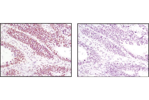 Immunohistochemistry Image 1: JMJD1B (C6D12) Rabbit Monoclonal Antibody
