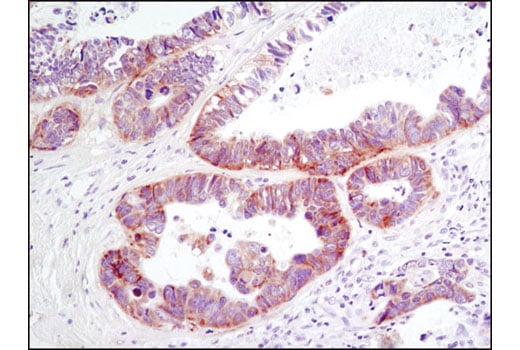 Immunohistochemistry Image 1: DDR1 (D1G6) Rabbit Monoclonal Antibody (BSA and Azide Free)