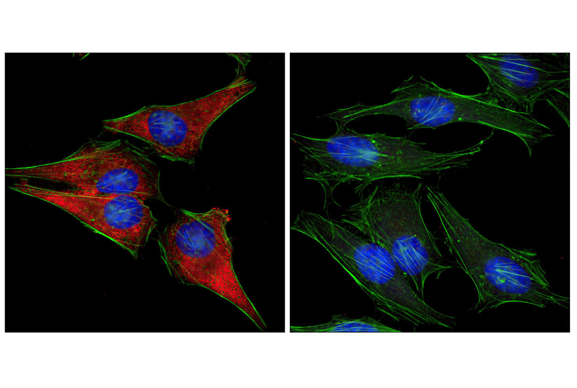 Immunofluorescence Image 1: S6 Ribosomal Protein (5G10) Rabbit Monoclonal Antibody (BSA and Azide Free)