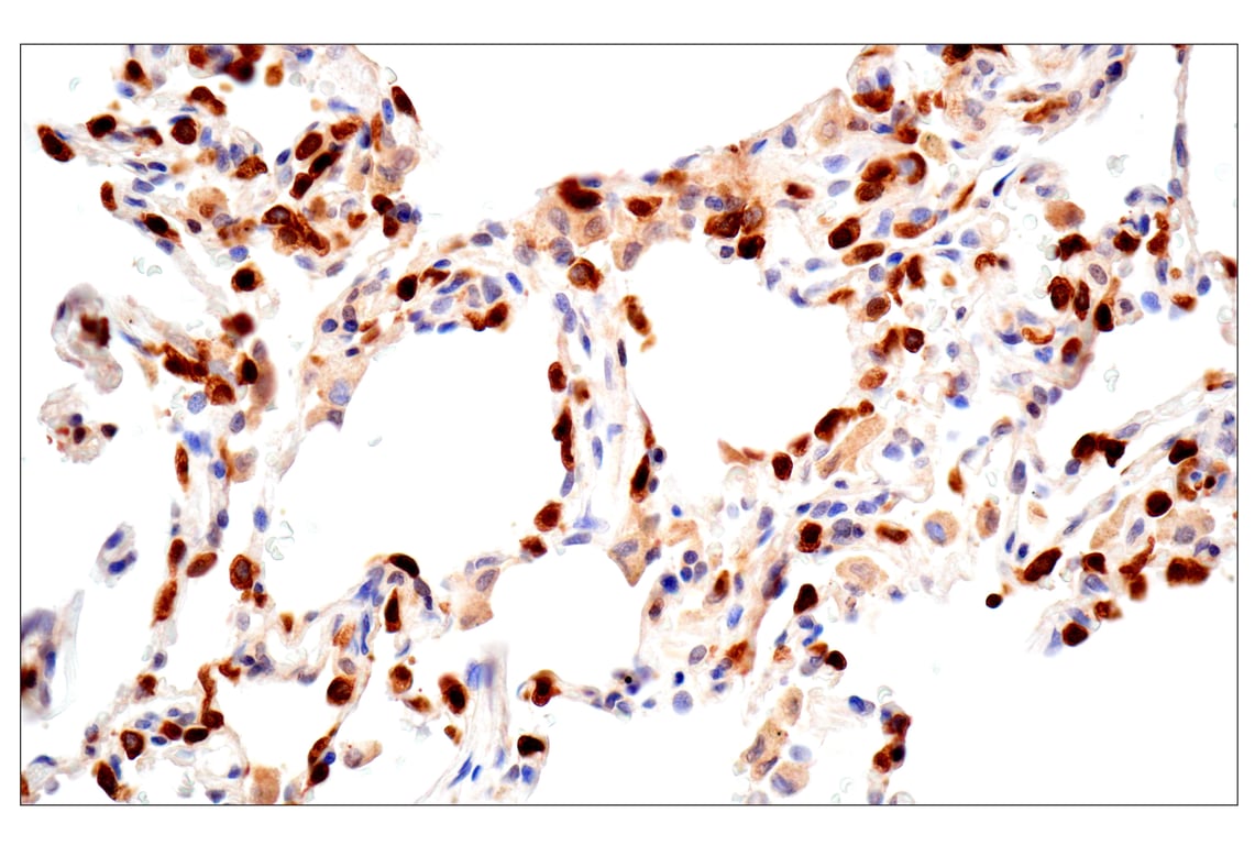 Immunohistochemistry Image 8: ACBP/DBI (E4V8V) Rabbit Monoclonal Antibody