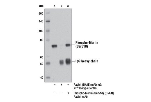 Immunoprecipitation Image 1: Phospho-Merlin (Ser518) (D5A4I) Rabbit Monoclonal Antibody