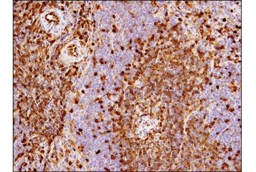 Immunohistochemistry Image 5: ASS1 (D4O4B) Rabbit Monoclonal Antibody