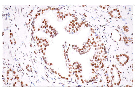 Immunohistochemistry Image 4: CPSF4 (E2L2Z) Rabbit Monoclonal Antibody