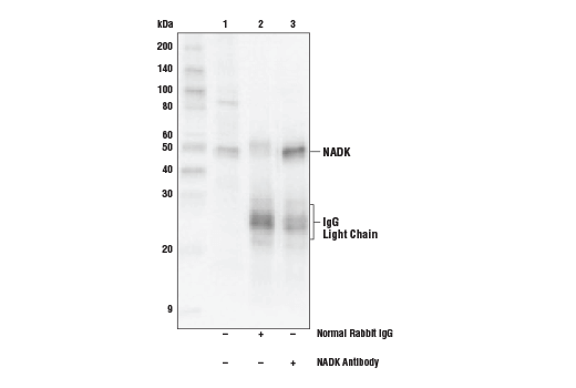 Immunoprecipitation Image 1: NADK Antibody