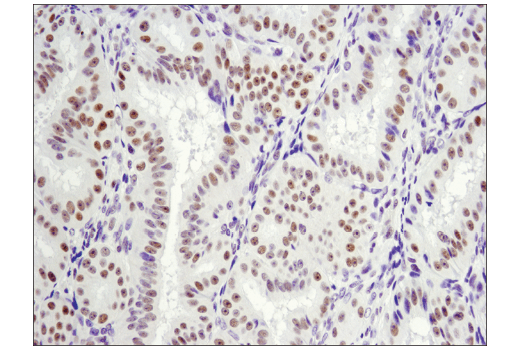 Immunohistochemistry Image 3: LRF/Pokemon (D7U2O) Rabbit Monoclonal Antibody (BSA and Azide Free)