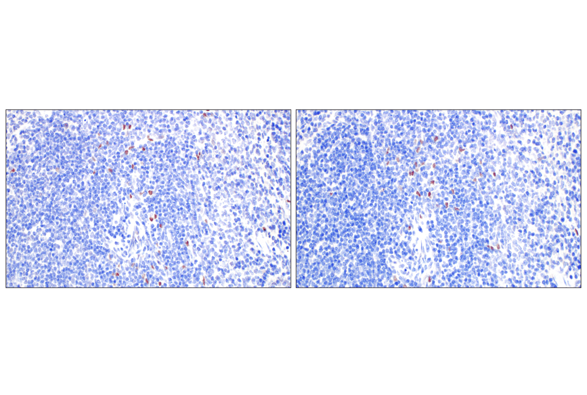 Immunohistochemistry Image 8: TCF4/ITF2 (E3X2Y) Rabbit Monoclonal Antibody