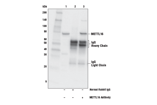 Immunoprecipitation Image 1: METTL16 Antibody
