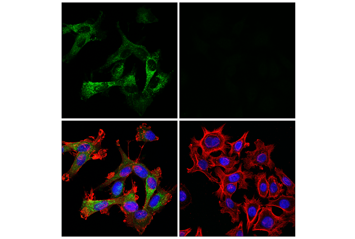 Immunofluorescence Image 2: Cathepsin L (E3R3P) Rabbit Monoclonal Antibody