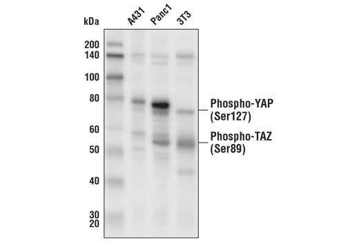 Western Blotting Image 4: Phospho-YAP (Ser127) (D9W2I) Rabbit Monoclonal Antibody (Biotinylated)