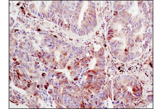Immunohistochemistry Image 4: Phospho-S6 Ribosomal Protein (Ser240/244) (D68F8) Rabbit Monoclonal Antibody (BSA and Azide Free)