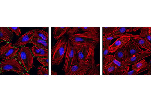 Immunofluorescence Image 1: Phospho-β-Catenin (Ser675) (D2F1) XP<sup>®</sup> Rabbit mAb