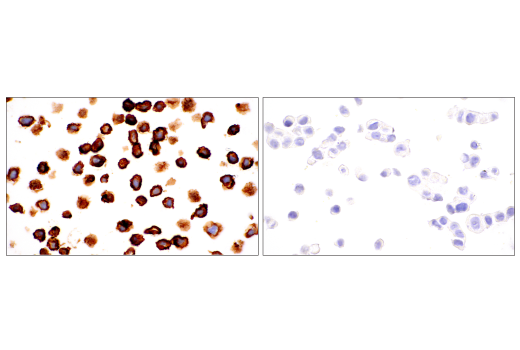 Immunohistochemistry Image 3: NG2/CSPG4 (E3B3G) Rabbit Monoclonal Antibody (BSA and Azide Free)