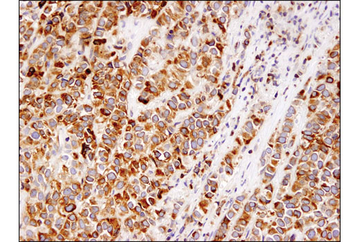 Immunohistochemistry Image 1: Bcl-2 (124) Mouse Monoclonal Antibody (BSA and Azide Free)