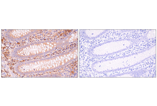 Immunohistochemistry Image 7: NF-kappaB1 p105/p50 (D7H5M) Rabbit Monoclonal Antibody (BSA and Azide Free)