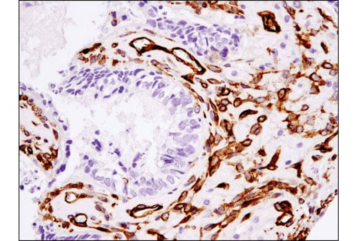 Immunohistochemistry Image 2: Cavin-1 (D1P6W) Rabbit Monoclonal Antibody