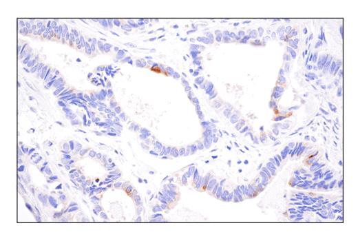Immunohistochemistry Image 3: 4-1BBL/CD137L/TNFSF9 (E8W3P) Rabbit Monoclonal Antibody