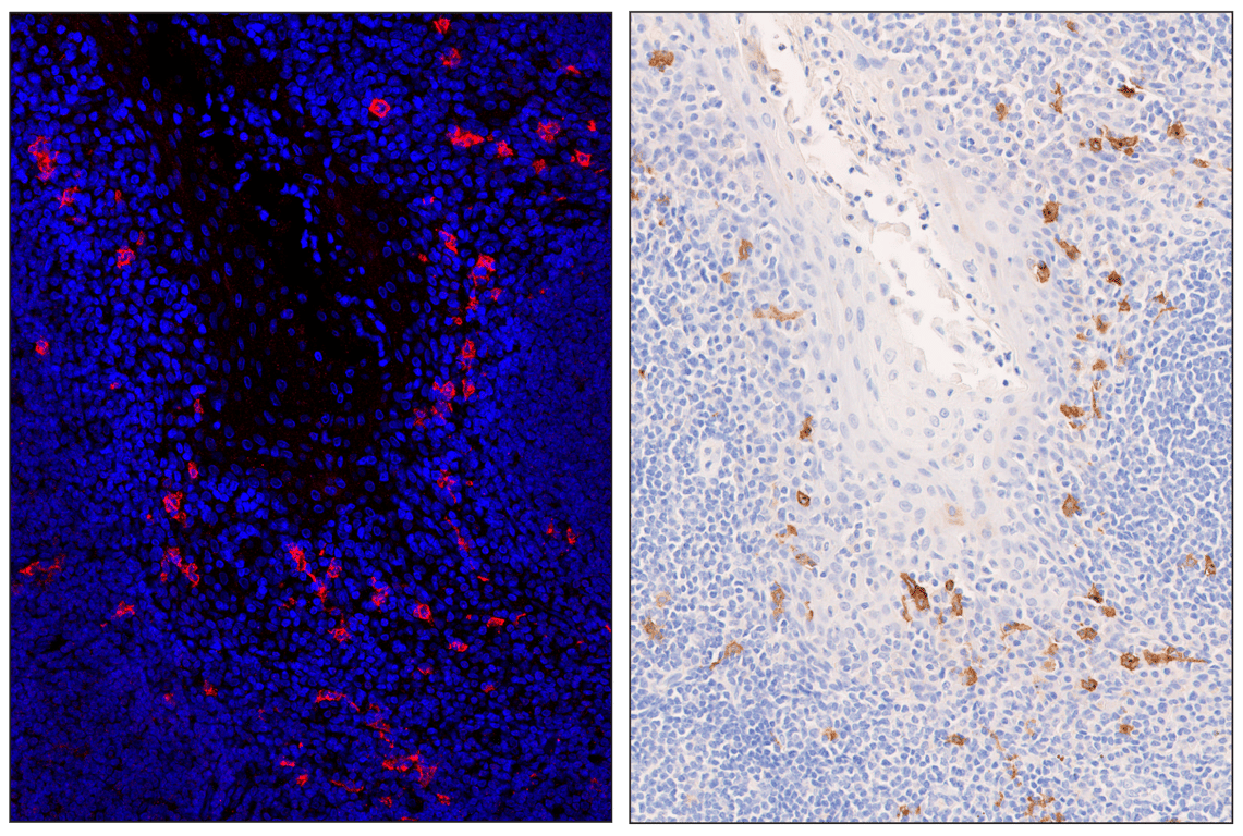 Immunohistochemistry Image 5: XCR1 (D2F8T) & CO-0015-488 SignalStar<sup>™</sup> Oligo-Antibody Pair