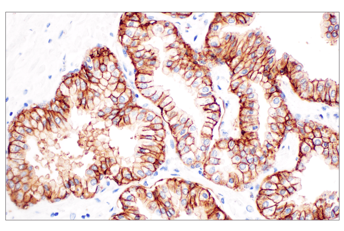 Immunohistochemistry Image 3: TACSTD2/TROP2 (F4W4J) Rabbit Monoclonal Antibody (BSA and Azide Free)