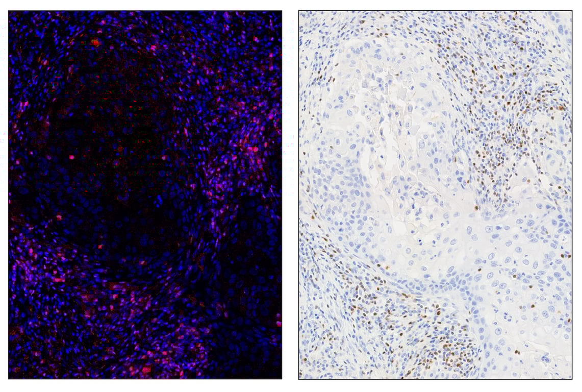 Immunohistochemistry Image 6: Tox/Tox2 (E6I3Q) & CO-0016-647 SignalStar<sup>™</sup> Oligo-Antibody Pair