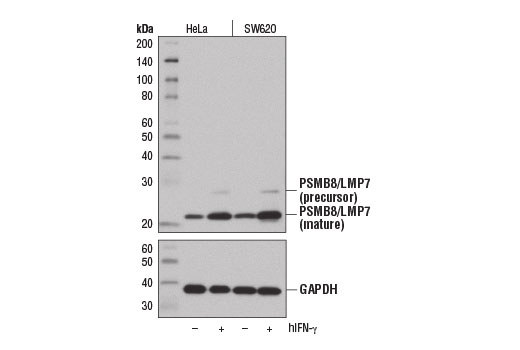 Western Blotting Image 2: PSMB8/LMP7 (1A5) Mouse Monoclonal Antibody