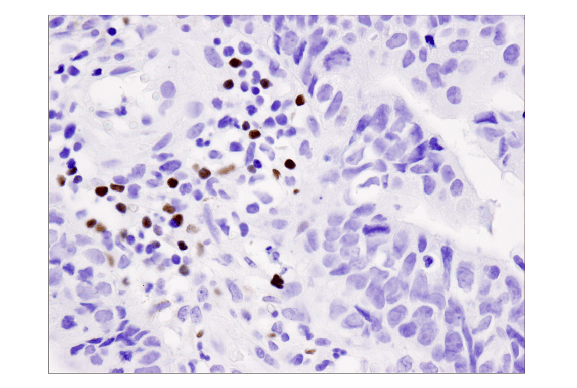 Immunohistochemistry Image 1: FoxP3 (D2W8E) Rabbit Monoclonal Antibody (BSA and Azide Free)