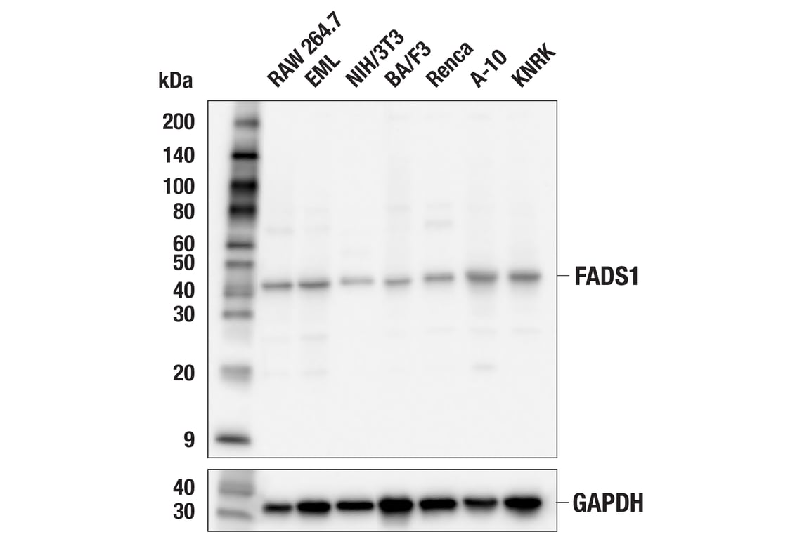 Western Blotting Image 2: FADS1 (F1D2A) Rabbit Monoclonal Antibody